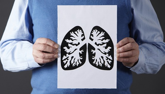 $49 Lung Cancer Screening